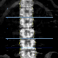 detail image4 DXA Bone Densitometry